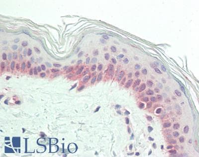 PathPlus™ CSPG4 / NG2 Antibody