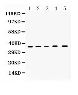 GAPDH Antibody