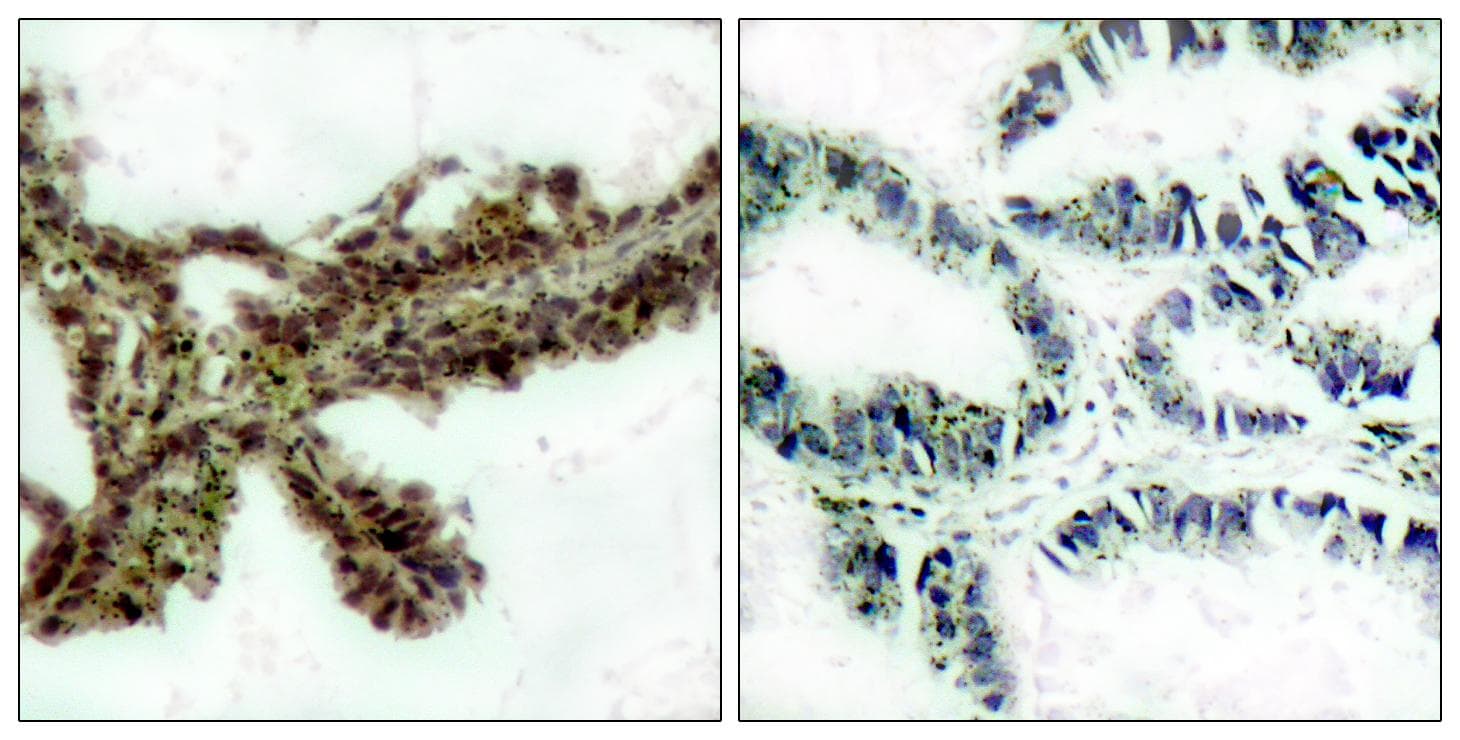 AKT1 Antibody (phospho-Thr308)