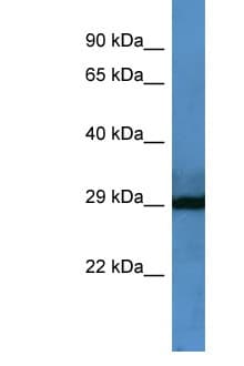 F7 / Factor VII Antibody (aa173-222)