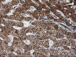 GATM / AGAT Antibody (clone 1C9, Carrier-free)
