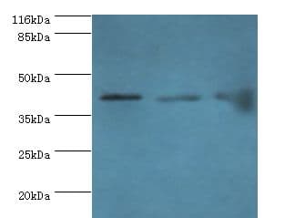 BCAT2 Antibody (aa28-392)