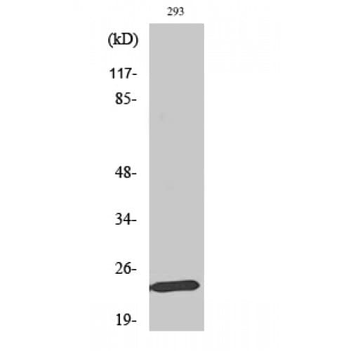 Polyclonal Rabbit anti-Human MOB1A Antibody (70-150 aa, Internal, IHC, WB)