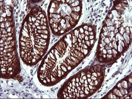EPCAM Antibody (clone OTI1H9)