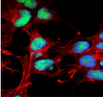 CHAT Antibody