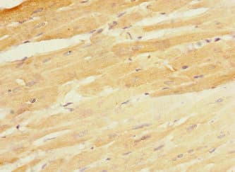 Polyclonal Rabbit anti-Human CBY1 / PGEA1 Antibody (IHC, WB)