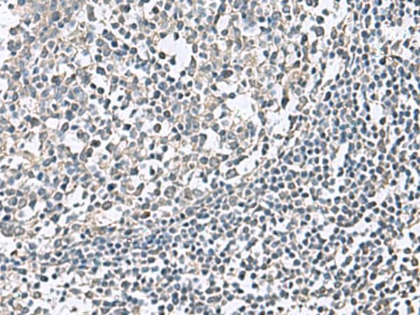 Polyclonal Rabbit anti-Human NPHP1 / Nephronophthisis Antibody (IHC)