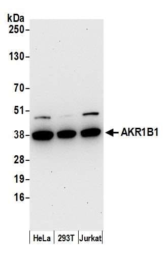 AKR1B1 / Aldose Reductase Antibody (aa1-50)