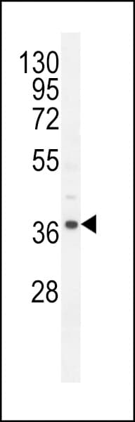 Polyclonal Rabbit anti-Human NDUFAF3 Antibody (aa12-40, IHC, WB)
