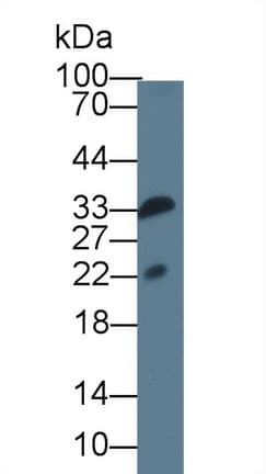 IL1F9 Antibody (aa5-149)