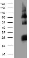 HARS2 Antibody (clone OTI2D6)