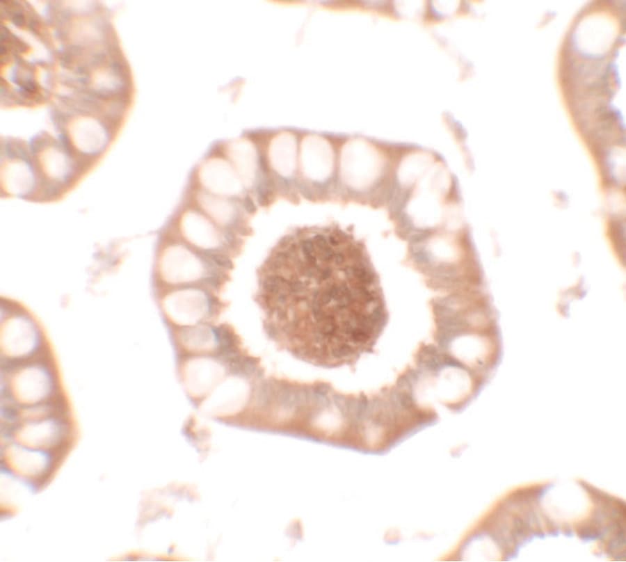 BTLA / CD272 Antibody