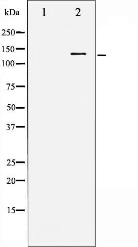 FGFR1 / FGF Receptor 1 Antibody (phospho-Tyr766)
