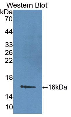 LIMCH1 Antibody (aa21-125, Biotin)