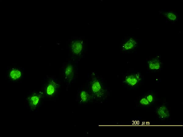 NEK11 Antibody (clone 4E1-1F4)