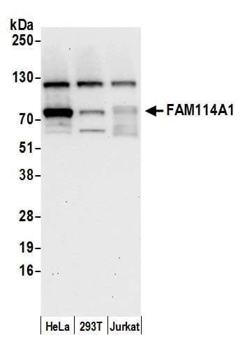 Polyclonal Rabbit anti-Human FAM114A1 / Noxp20 Antibody (aa75-125, WB)