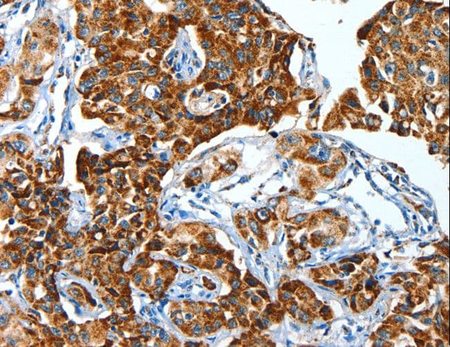 ALDH6A1 Antibody