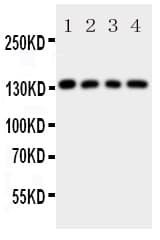 Polyclonal Rabbit anti-Human LAMC2 / Laminin Gamma 2 Antibody (aa1160-1180, IHC, WB)