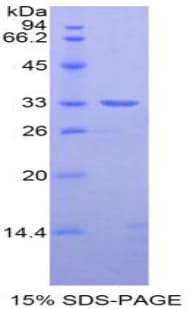 Rat NEXN / Nexilin Protein (Recombinant His-T7)