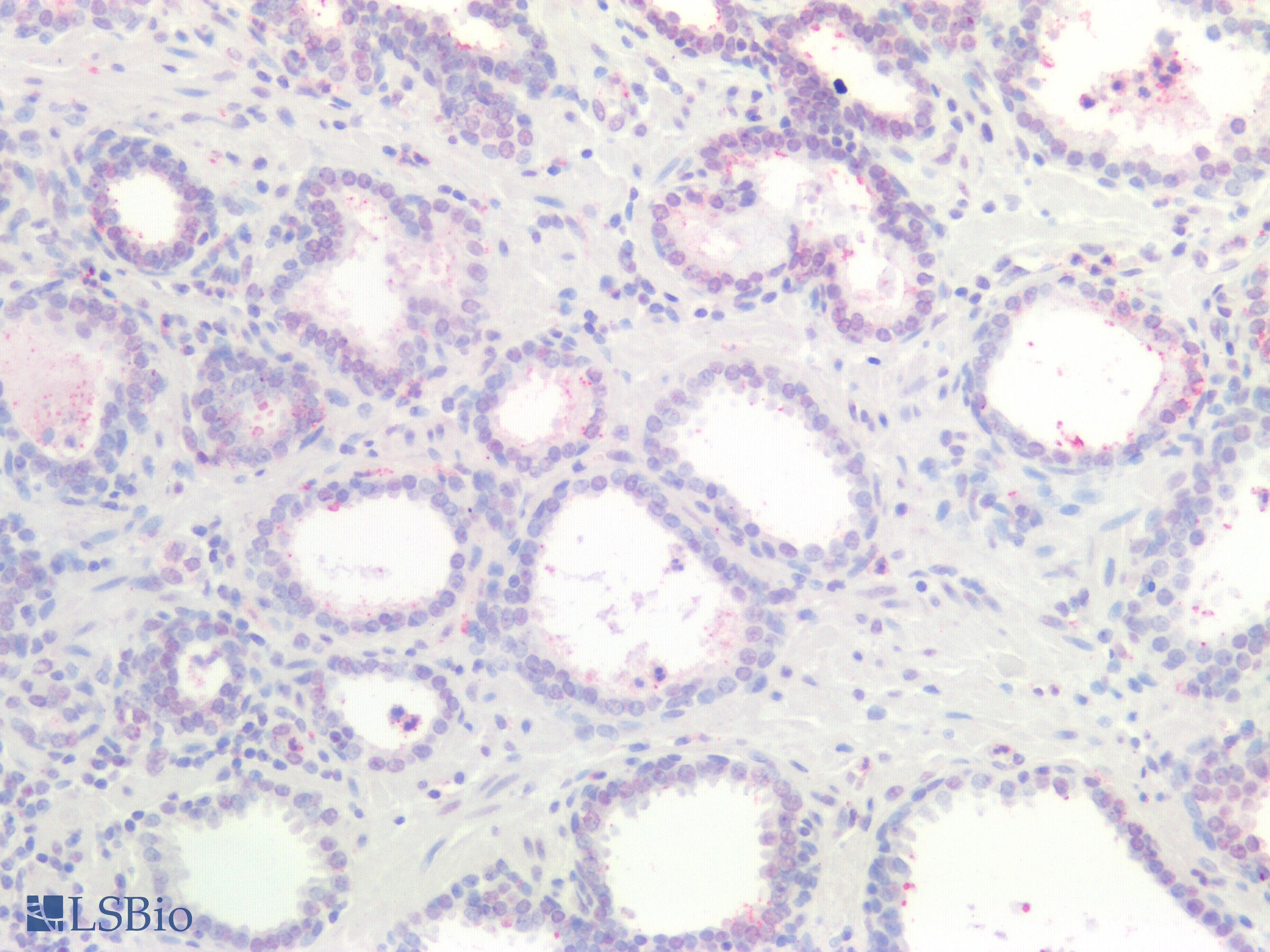 IHC-plus™ KRAS Antibody
