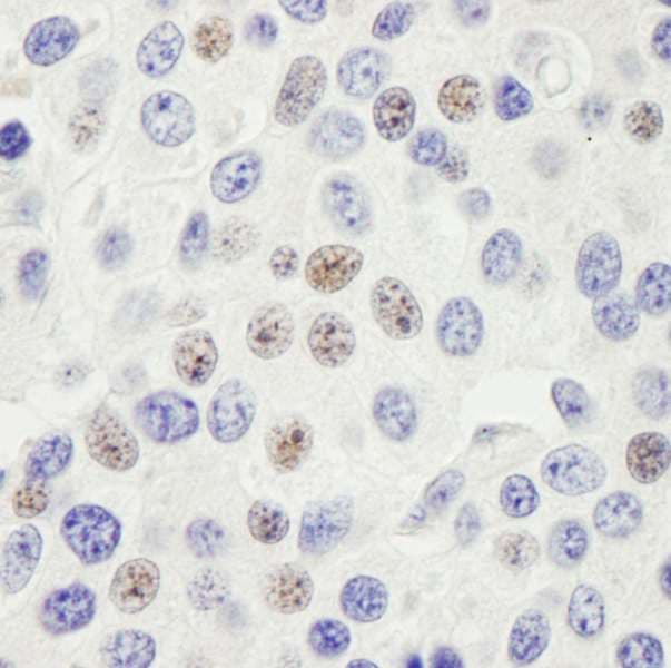Polyclonal Rabbit anti-Human PHF6 Antibody (aa1-50, IHC, WB)