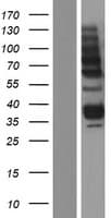 Human AGA / Aspartylglucosaminidase Protein (Over-Expression Lysate Myc-DDK (Flag))