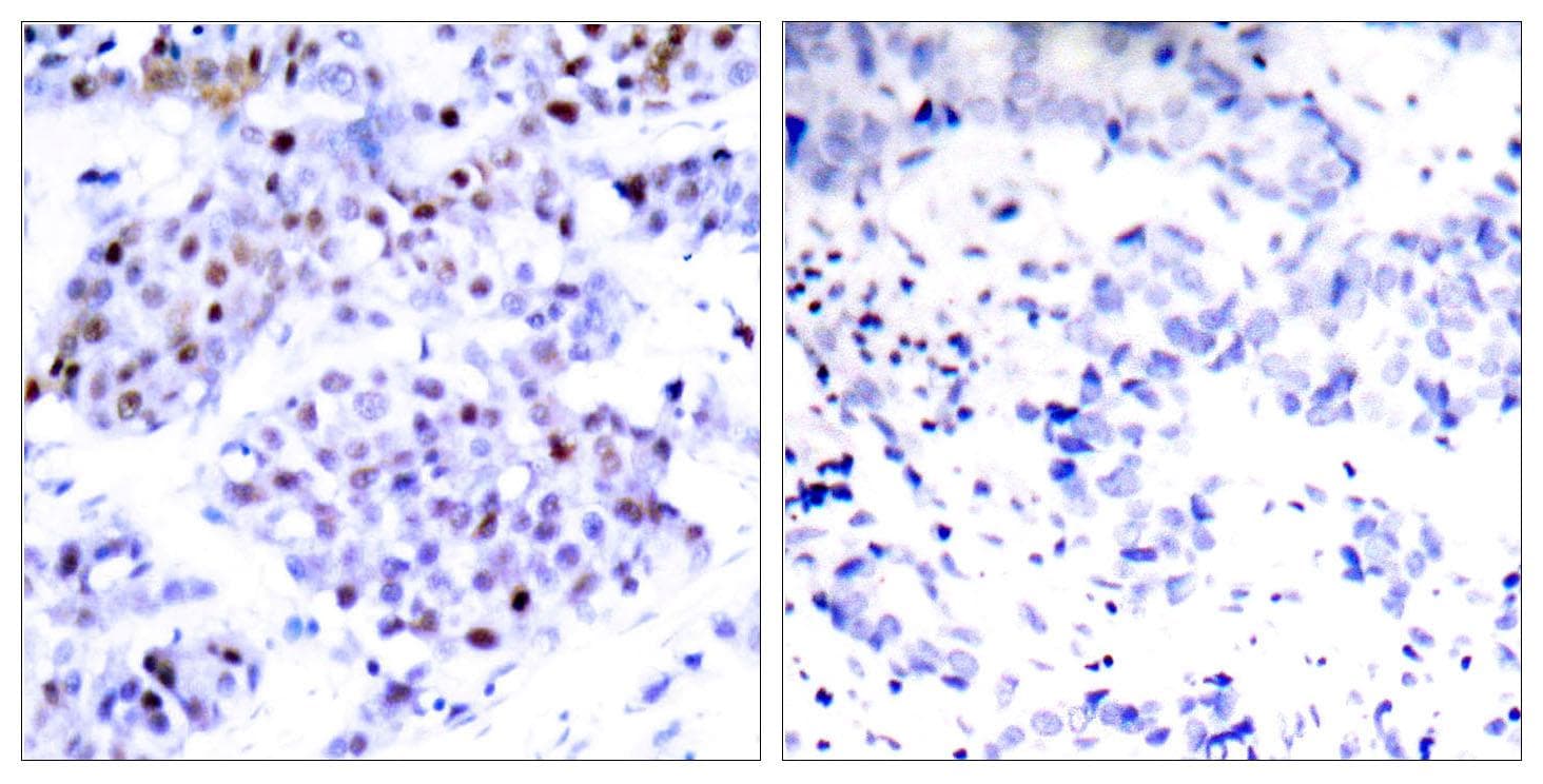 STAT6 Antibody (p645)