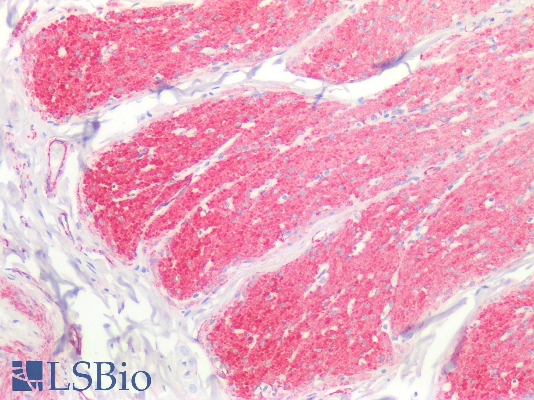 PathPlus™ CALD1 / Caldesmon Antibody (aa1-240)