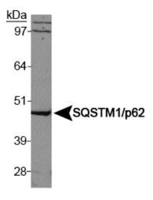 SQSTM1 Antibody