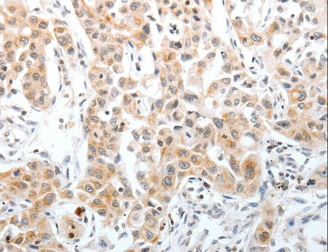 SLC22A3 / OCT3 Antibody