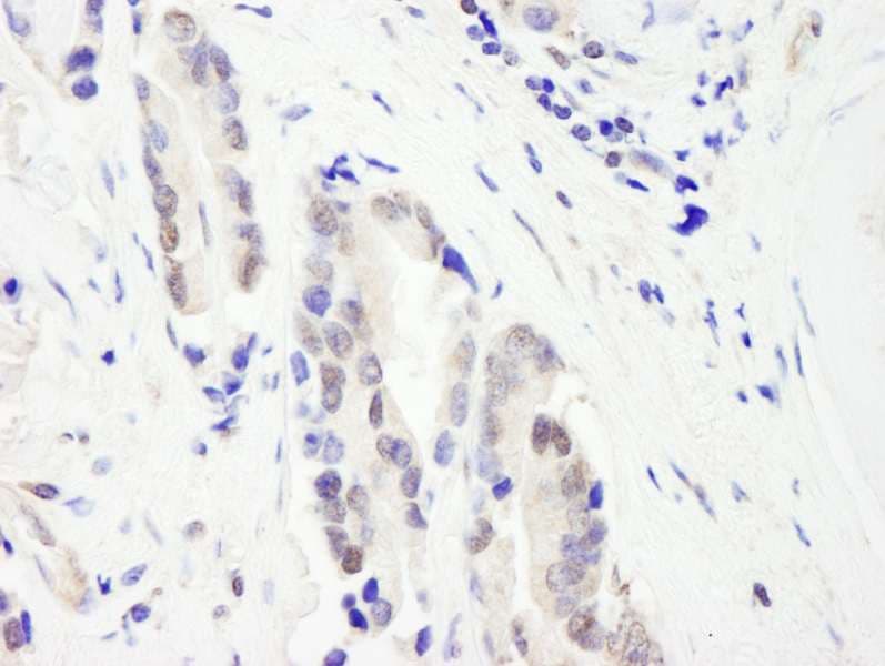 Polyclonal Rabbit anti-Human CHD3 Antibody (aa1575-1625, IHC, WB)