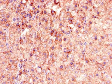 PHLDB2 Antibody