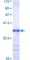 Human FXR1 Protein (Recombinant GST, N-terminus)