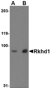 MEX3D Antibody
