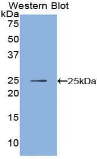 IKBIP Antibody (aa132-314)