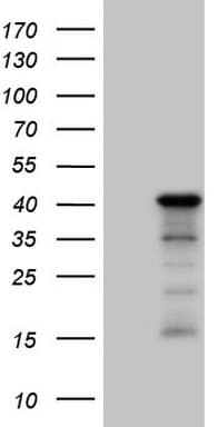 Monoclonal Mouse anti-Human SETD8 / SET8 Antibody (clone OTI3G9, IHC, WB)