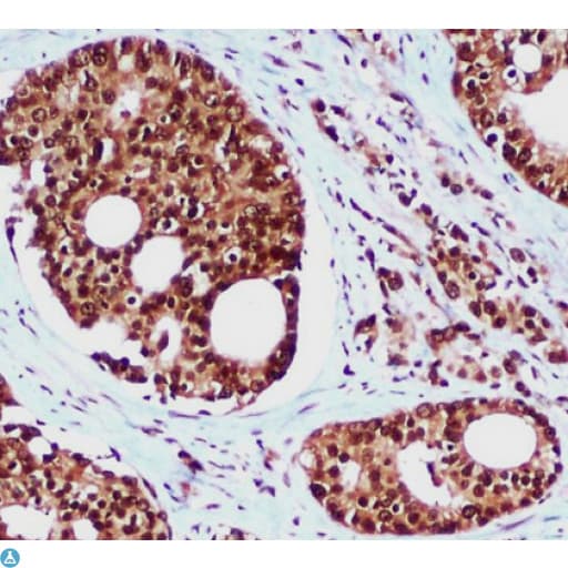 RAD23B / HR23B Antibody