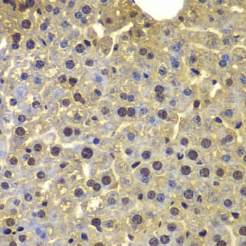 SORT1 / Sortilin Antibody