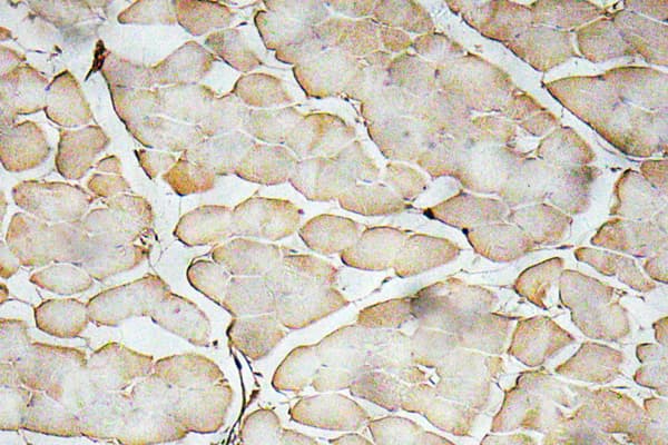 VEGFA / VEGF Antibody (aa110-159)