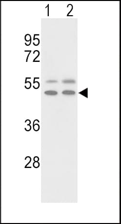 VTN / Vitronectin Antibody (aa352-379)