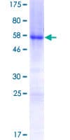 Human HOXB5 Protein (Recombinant GST)