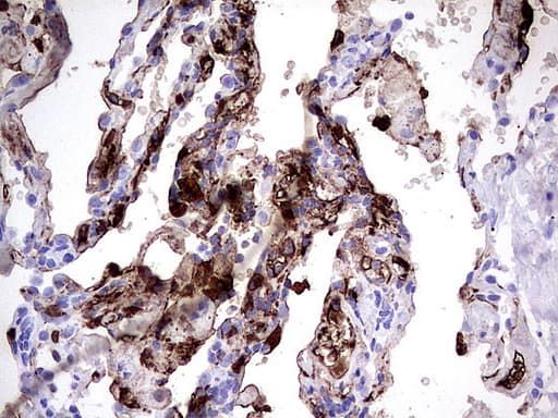 Monoclonal Mouse anti-Human S100A9 / MRP14 Antibody (clone UMAB173, Carrier-free, IHC, IF, WB)