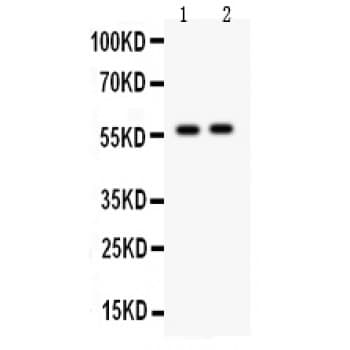 CYP7A1 Antibody (aa301-504)