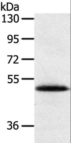 Polyclonal Rabbit anti-Human SMOC2 Antibody (aa 433-446, IHC, WB)
