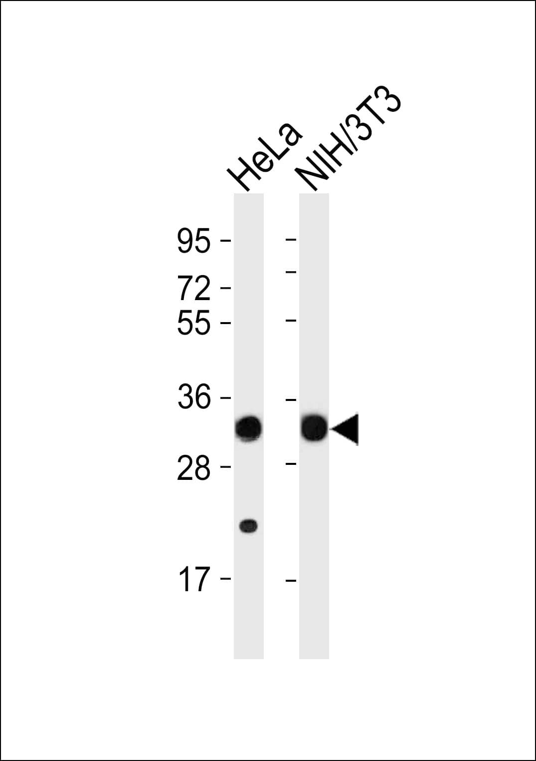 PathPlus™ RPS2 / Ribosomal Protein S2 Antibody