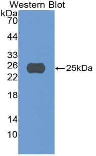 CASP5 / Caspase 5 Antibody (aa145-327)
