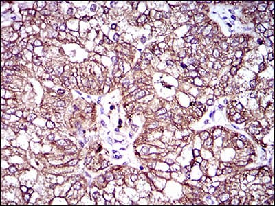 ABCC4 / MRP4 Antibody (aa631-692, clone 6A7H3)