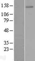 ZNF521 Protein (Over-Expression Lysate Myc-DDK (Flag))