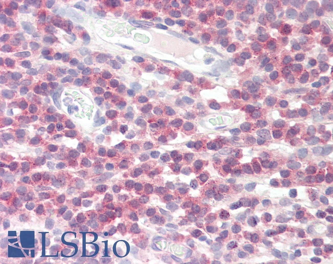 IHC-plus™ DPM1 Antibody (aa15-28)