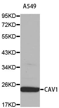 CAV1 / Caveolin 1 Antibody
